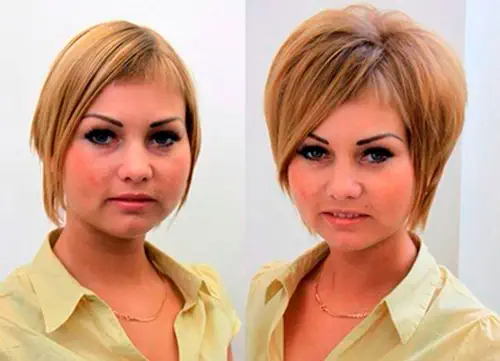 Буст Ап фото до и после в салоне Dozari на Тверской